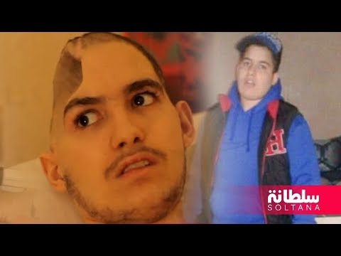 شاهد  شاب يفقد نصف جمجمته وغادر الدراسة