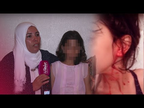 الطفلة آية تنزف الدم من كل جسدها