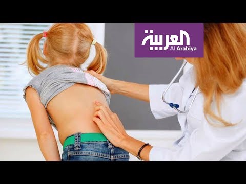 بالفيديو الجلوس أمام الأجهزة لا يسبب انحرافات العمود الفقري