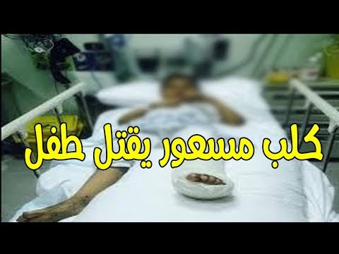 شاهد عضة كلب ترسل طفلًا في أغادير إلى القبر