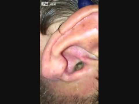 شاهد رجل يُصوِّر أذنه بالموبايل فيجد مفاجأة مرعبة