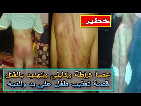 شاهد أب وأم مغربيان يعذبان نجلهما بالعصا في الدار البيضاء