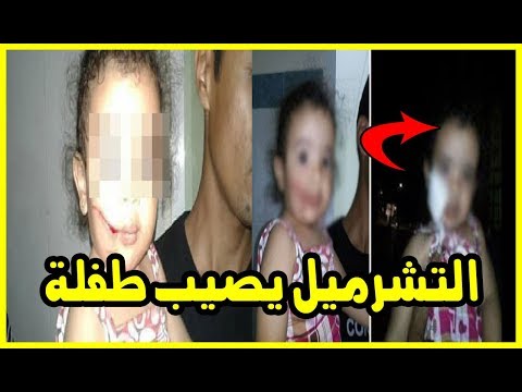 تعرض طفلة في ربيعها الثاني للاعتداء عليها