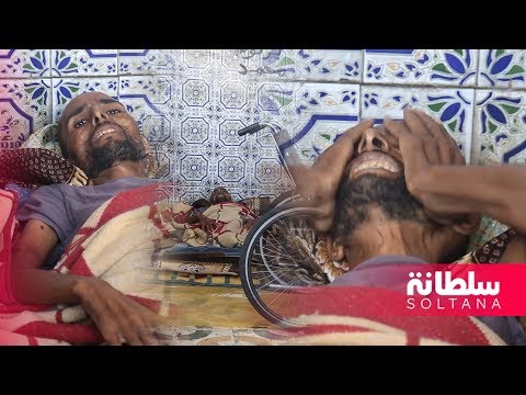 عبد الخالق عقب قيام الأطباء ببتر قدميه