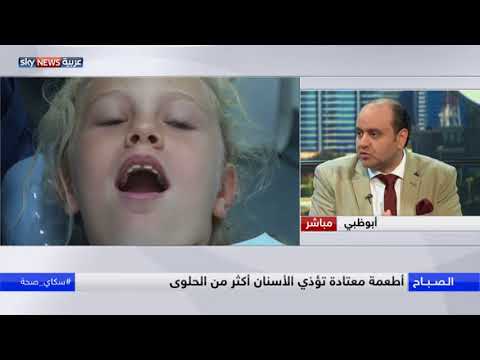 الأطباء يوصون بالتقليل من الحلوى