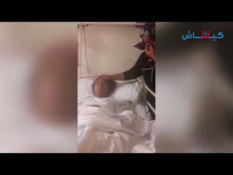 شاهد طفلة في حاجة إلى عملية زراعة الكبد