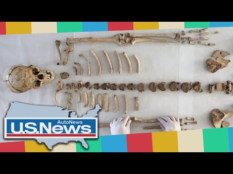 اكتشاف أول هيكل عظمي أثري لشخص مصاب بالجذام