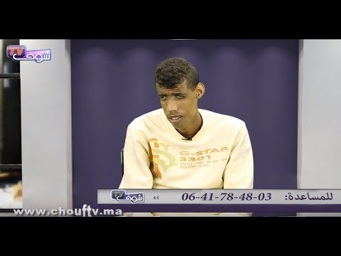 شاهد  مرض نادر و غريب يصيب شابًا في عمر الزهور