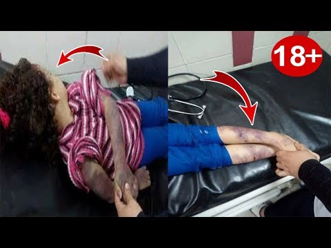 شاهد أب ينهي حياة طفلته لسبب غريب