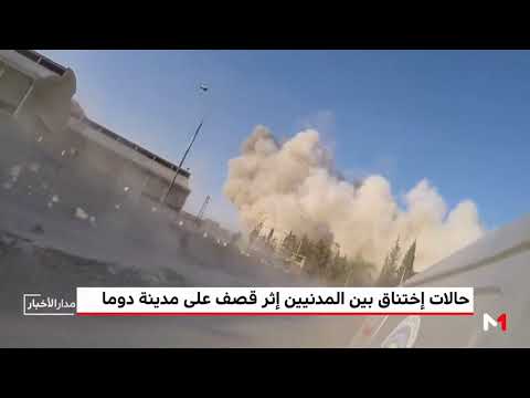 حالات اختناق بين المدنيين إثر قصف على مدينة دوما