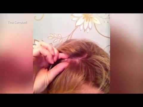 فيديو فتاة تفقد شعرها بسبب باروكة