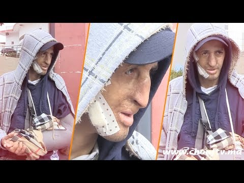 شاهد أم شاب يعاني الصرع تستغيث بجلالة الملك