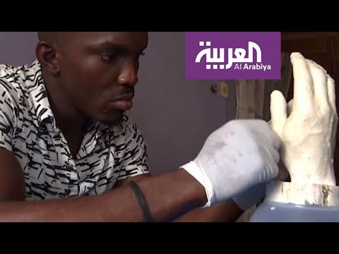 شاهد نيجيري لا يريد الشفقة مع مبتوري الأطراف
