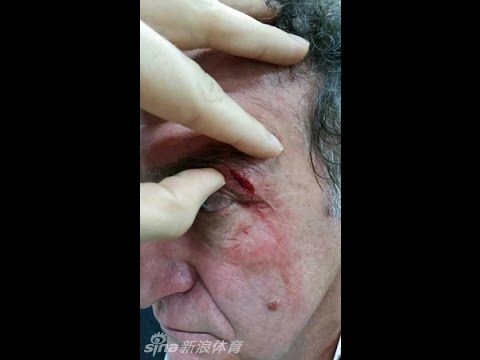 بالفيديو مدرب صينى يدفع ثمنًا باهظًا لتهور لاعبيه