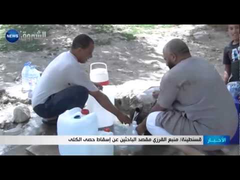 شاهد منبع القرزي لإسقاط حصى الكلى