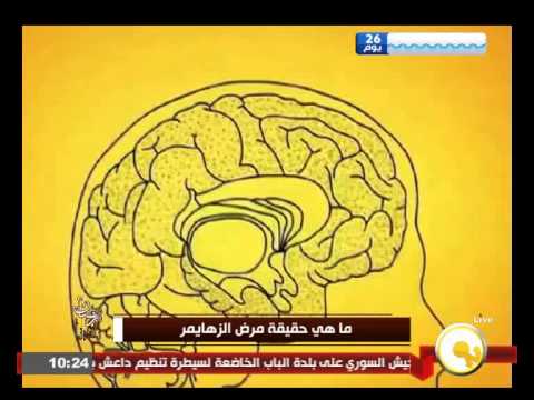 ماهية مرض الزهايمر وأسبابه