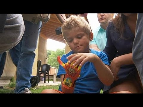 شاهد طفل فرنسي يحصل على يد اصطناعية ثلاثية الأبعاد