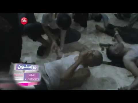 شاهد حالات كثيرة من الكيماوي لا يستطيع الأطباء استيعابها