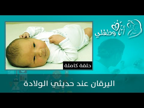 اسباب اليرقان عند حديثي الولادة