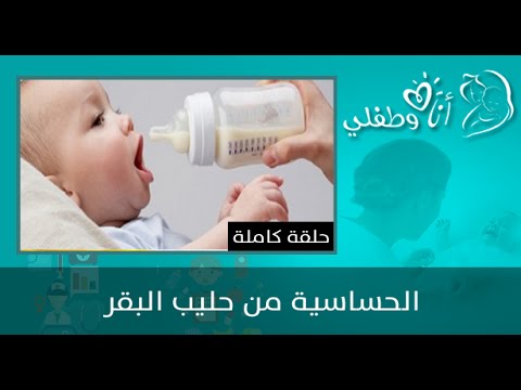 شاهد الحساسية من حليب البقر