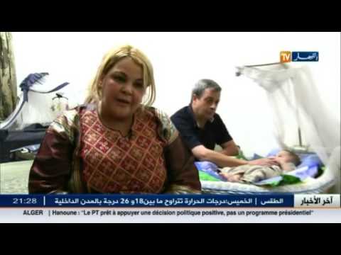 شاهد علامات غريبة تظهر على جسم رضيع