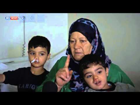 شاهد هيوا يعالج مرضى السرطان مجانًا