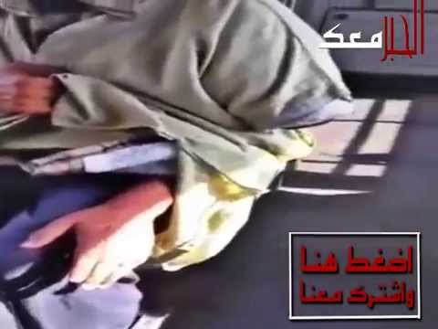 شاهد كشف حيلة متسول مقطوع اليد في الدار البيضاء