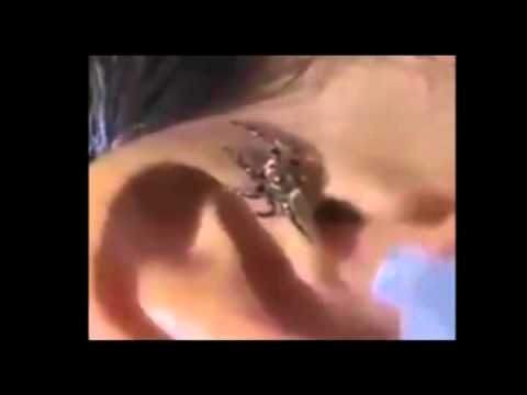شاهد عنكبوت يدخل أذن رجل وهو نائم