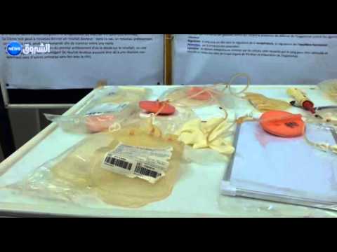 تضارب في الأرقام حول المصابين بداء السيدا في الجزائر