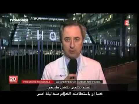 شاهد عامان فقط على أول عملية زراعة قلب صناعى بالكامل فى التاريخ