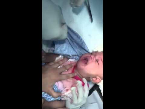 شاهد عملية نزع ساعة يد من حلق رضيع في السعودية