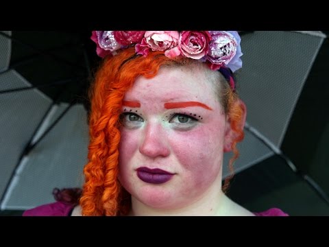 شاهد مرض جلدي نادرجعل من فتاة تحترق وهي على قيد الحياة