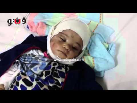 شاهد سيدة تتهم أختها بحرق ابنها