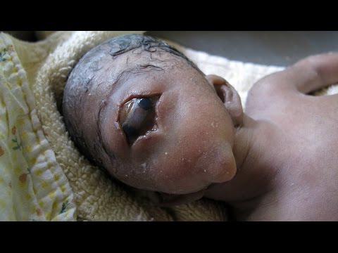 5   أطفال لن تصدق وجودهم حقًا