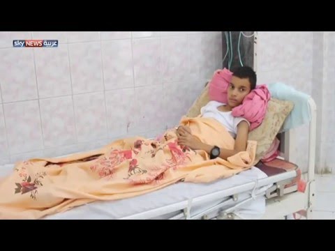 شاهد تفاقم الإصابات بحمى الضنك في المكلا