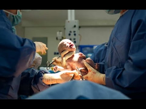 شاهد ولادة أكثر من 7 آلاف جنين ميتًا يوميًا