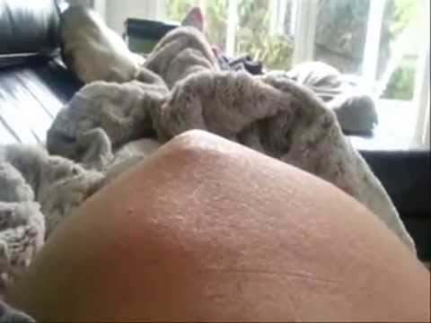 بالفيديو جنين يتحرك داخل بطن والدته بطريقة مريبة