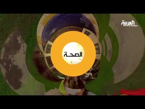شاهد مشكلة انحراف أصبع القدم