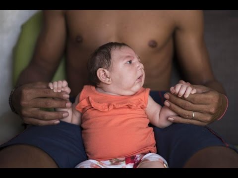 ما هي أعراض الاصابة بفايروس زيكا وآلية العلاج