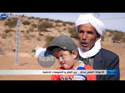 الطفل مختار بين الفقر والتشوهات الخلقية