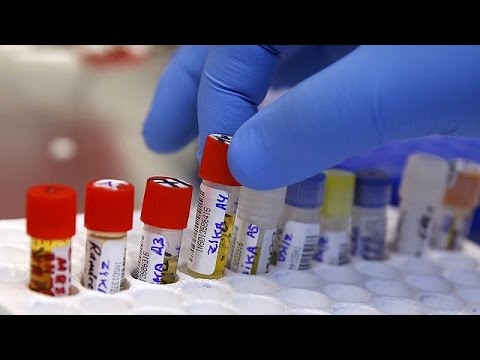 السلطات الطبية الأميركية تؤكد أن زيكا انتقل عبر الجنس في تكساس