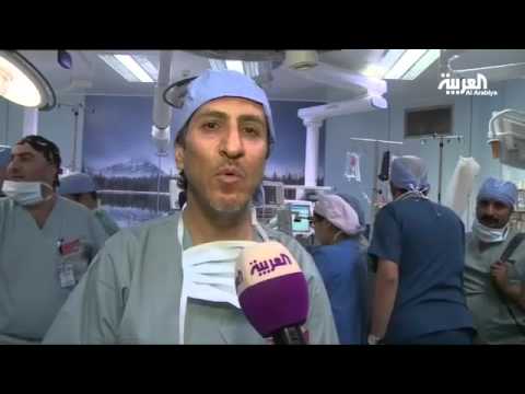 انفصال ناجح للتوأمان السياميان السوريان تقى ويقين