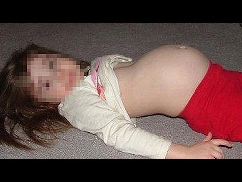 اغرب 8 حالات ولادة في العالم