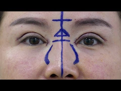 plastic surgery has become a big business in china
